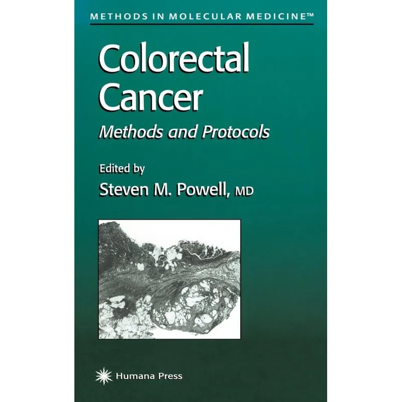 Colorectal Cancer