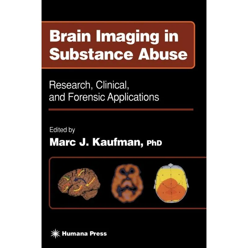Brain Imaging in Substance Abuse