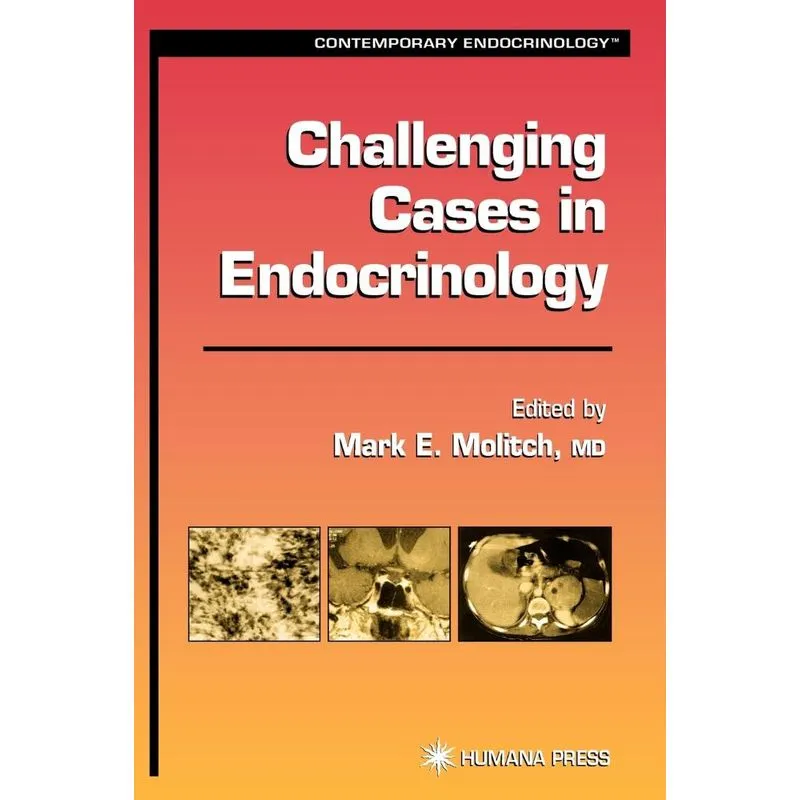 Challenging Cases in Endocrinology