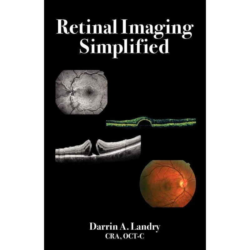 Retinal Imaging Simplified