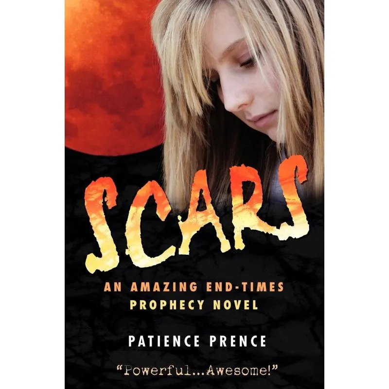 Scars