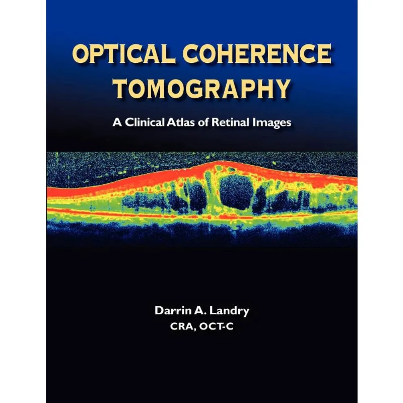 Optical Coherence Tomography a Clinical Atlas of Retinal Images