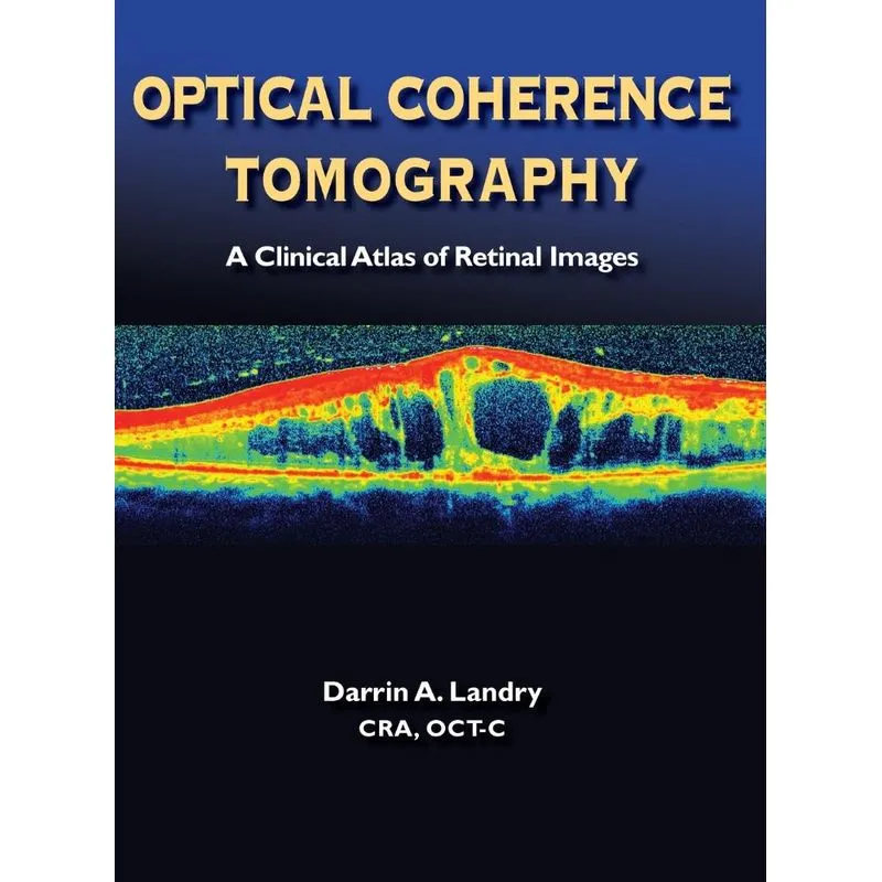 Optical Coherence Tomography