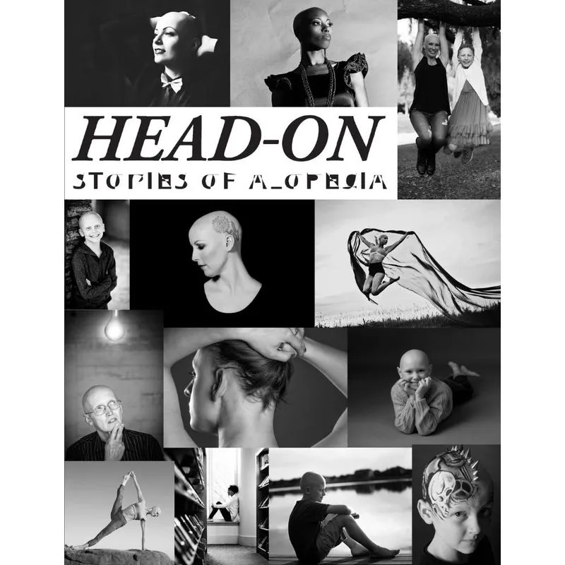 Head-On, Stories of Alopecia
