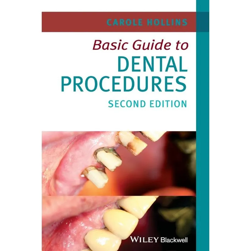 Basic Guide To Dental Procedures 2e