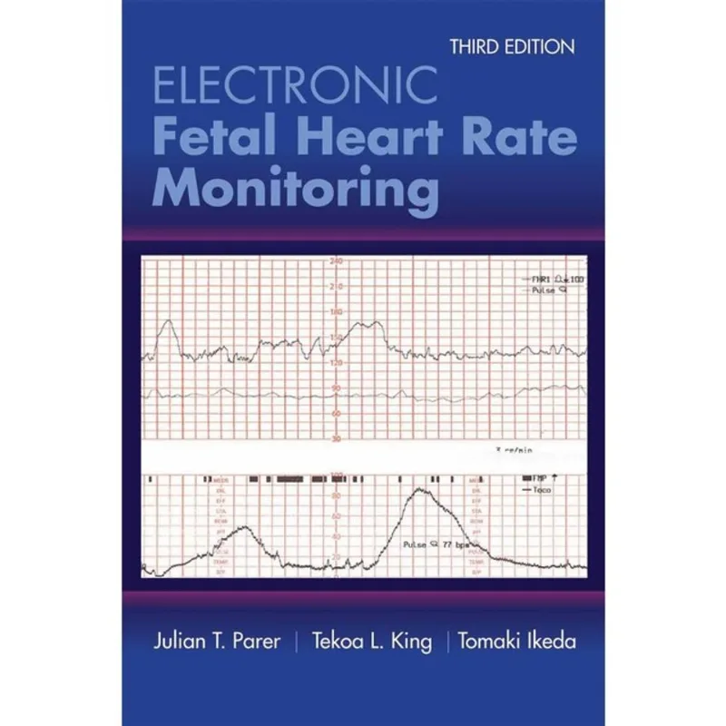 ELECTRONIC FETAL HEART RATE MONITORING