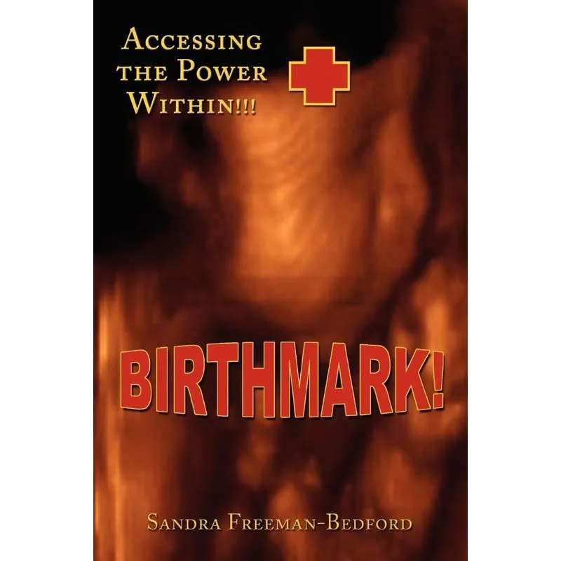 Birthmark!