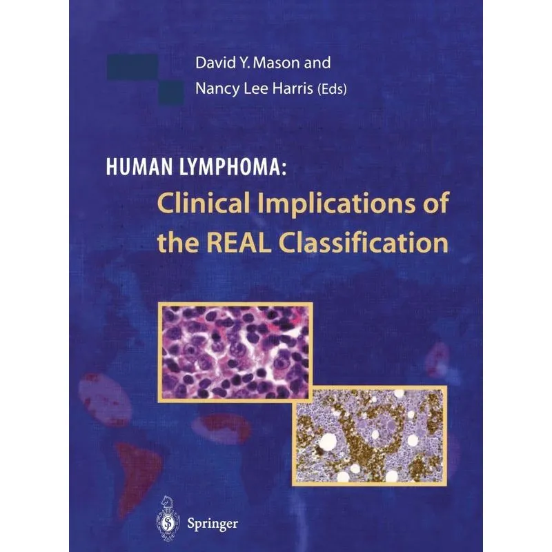 Human Lymphoma