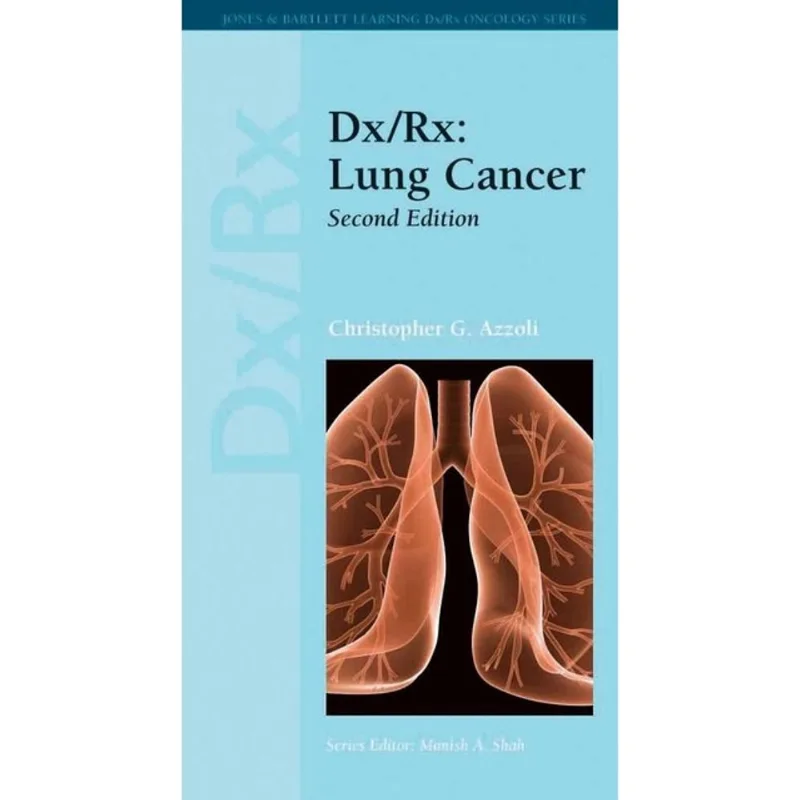 DX/RX - LUNG CANCER
