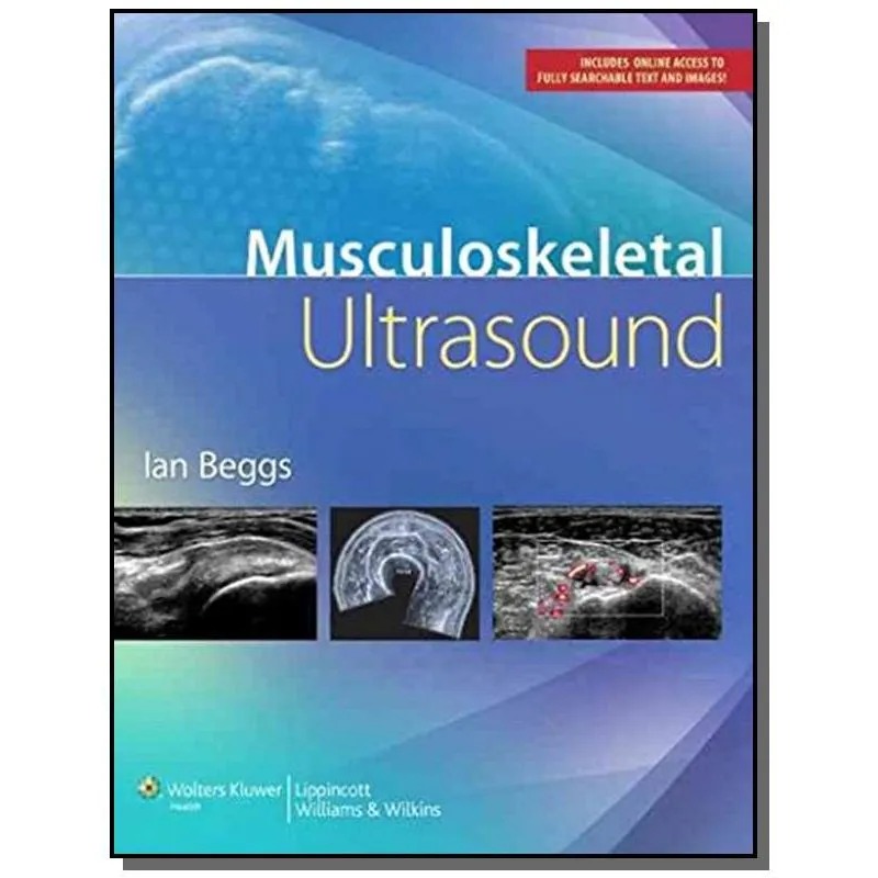 Musculoskeletal Ultrasound