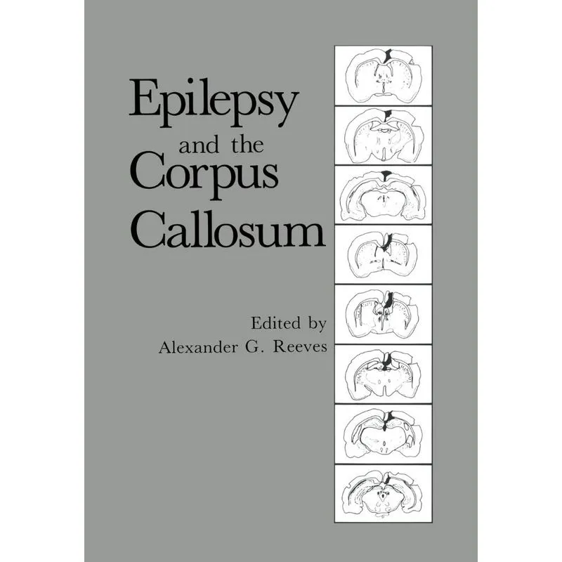 Epilepsy and the Corpus Callosum