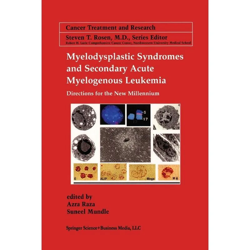 Myelodysplastic Syndromes & Secondary Acute Myelogenous Leu