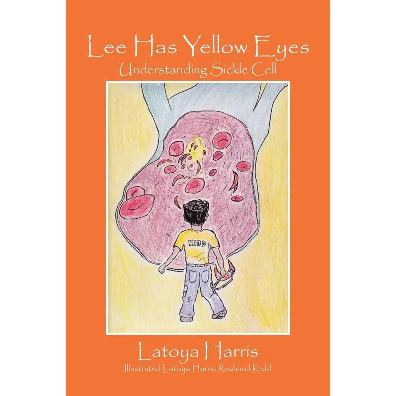 Lee Has Yellow Eyes