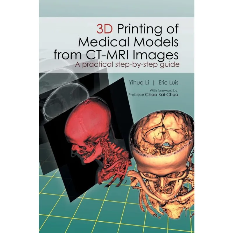 3D Printing of Medical Models from ct-mri Images