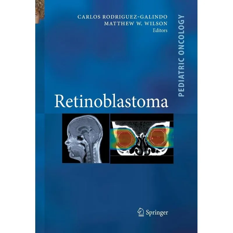 Retinoblastoma