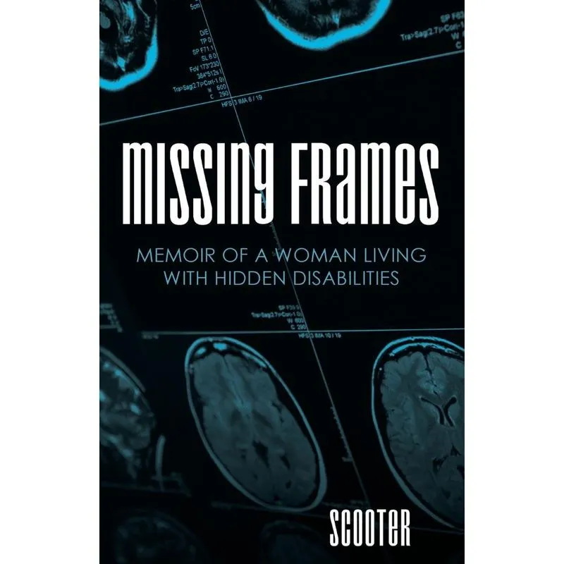 Missing Frames