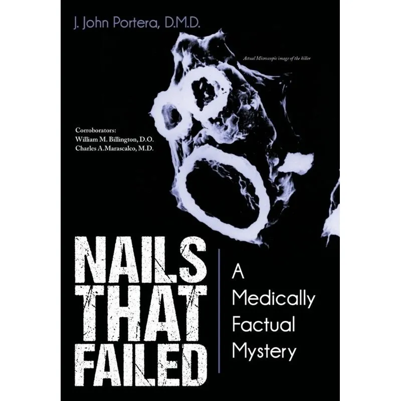 Nails That Failed