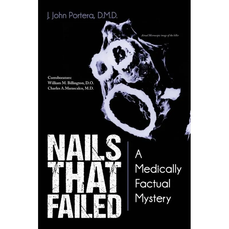 Nails That Failed
