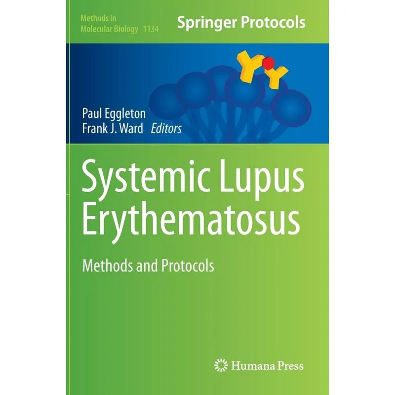 Systemic Lupus Erythematosus