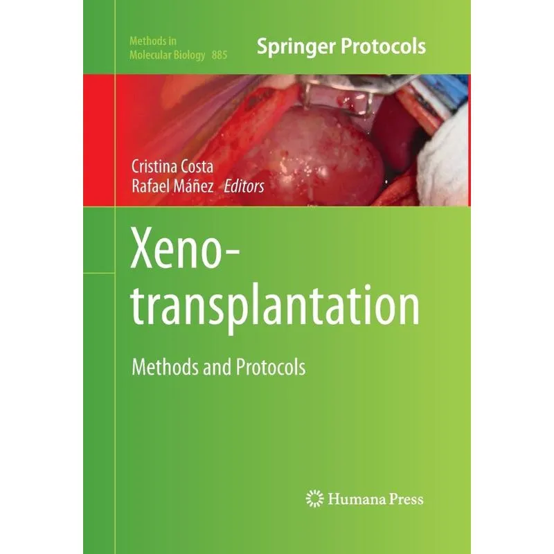 Xenotransplantation