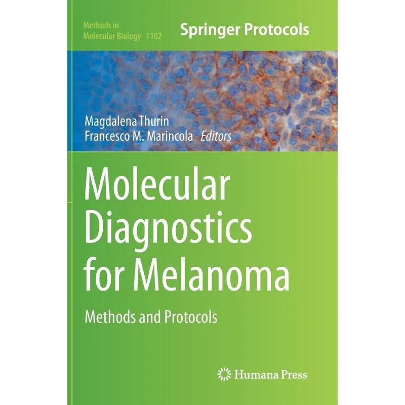 Molecular Diagnostics for Melanoma