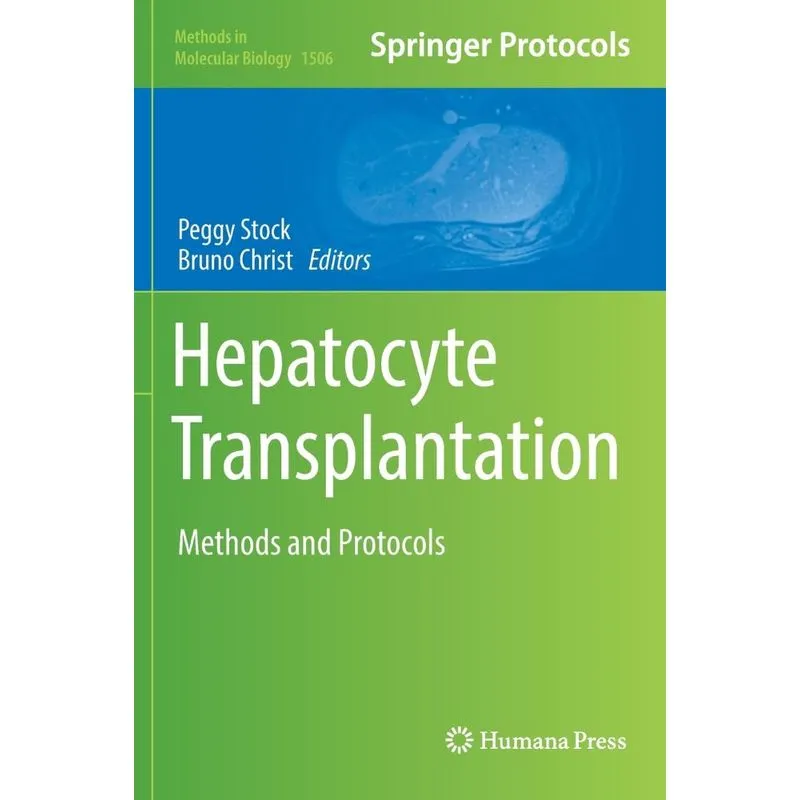 Hepatocyte Transplantation