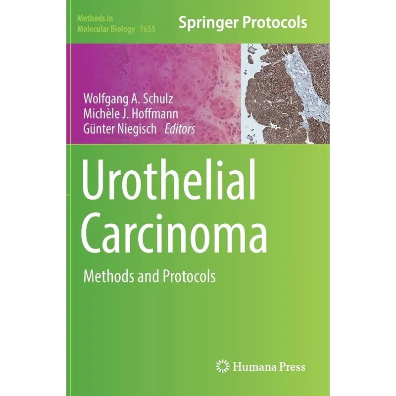 Urothelial Carcinoma