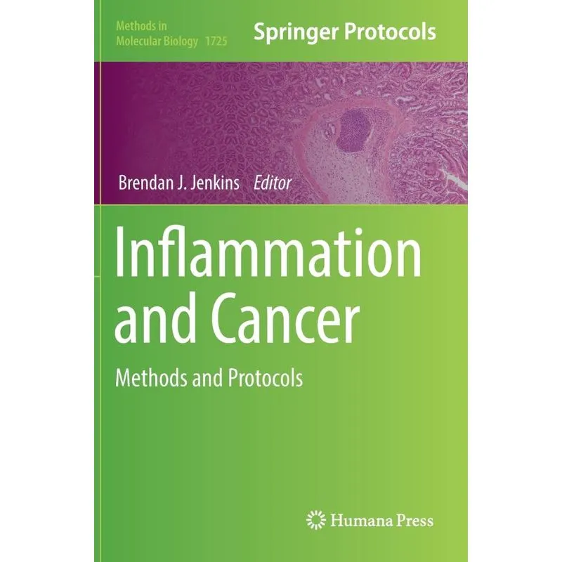 Inflammation and Cancer