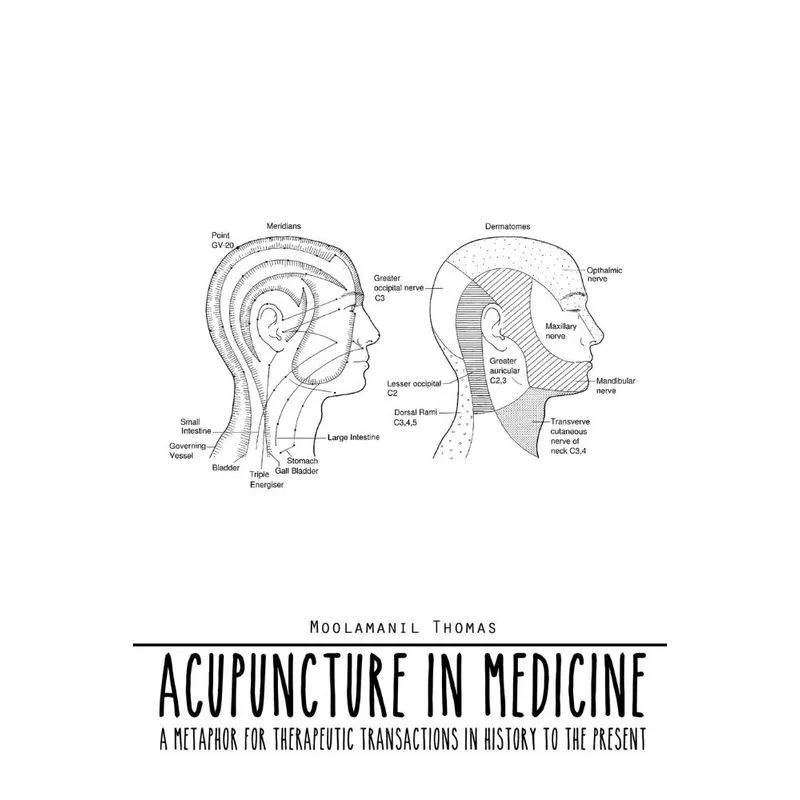 Acupuncture in Medicine