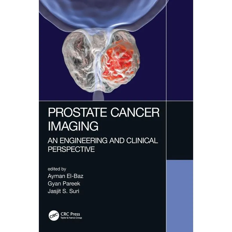 Prostate Cancer Imaging
