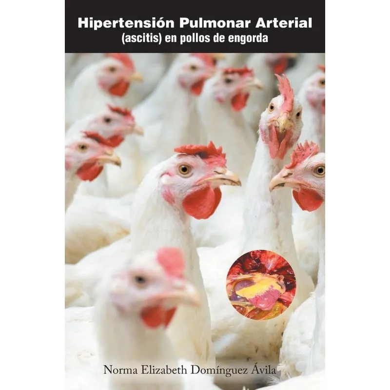 Hipertensión pulmonar arterial