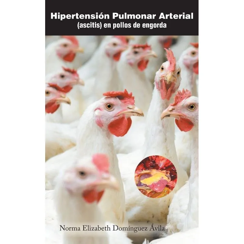 Hipertensión pulmonar arterial