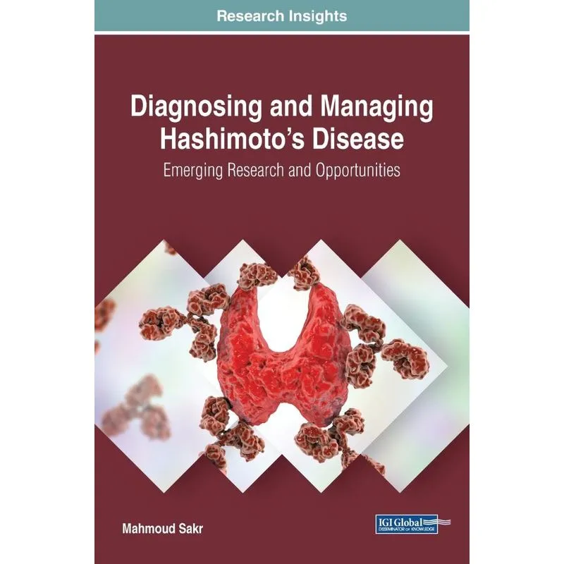 Diagnosing and Managing Hashimotos Disease