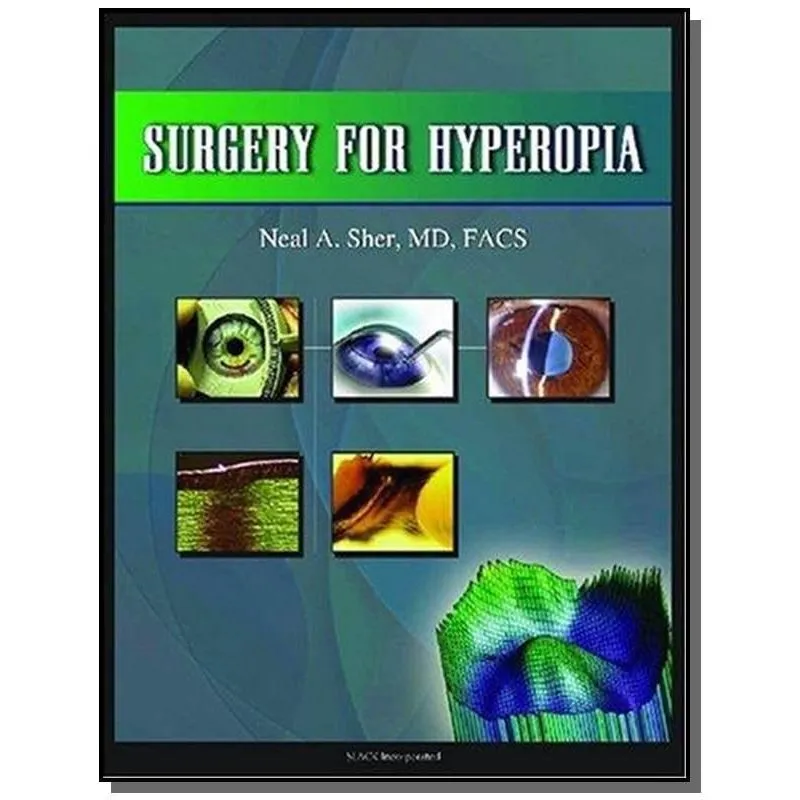 Surgery For Hyperopia
