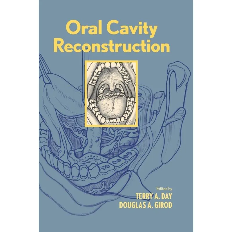 Oral Cavity Reconstruction