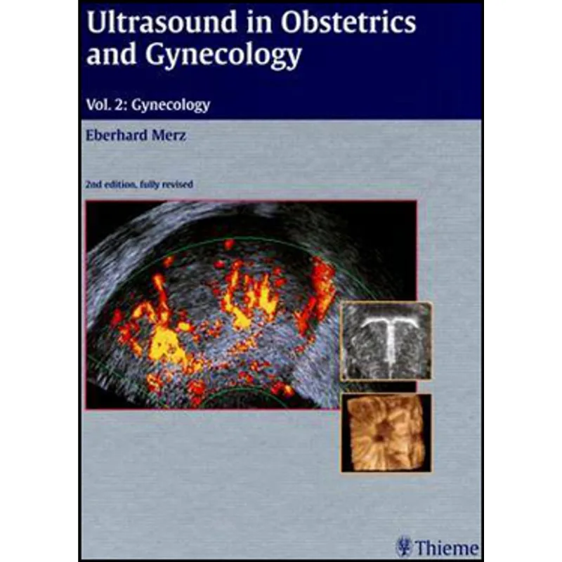 ULTRASOUND IN OBSTETRICS AND GYNECOLOGY
