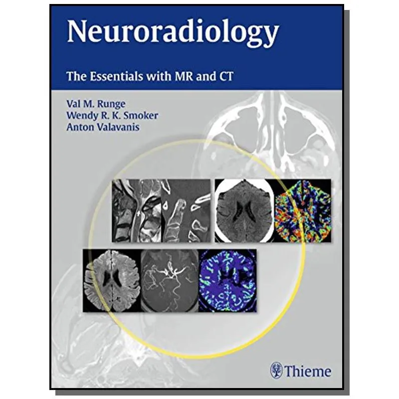Neuroradiology