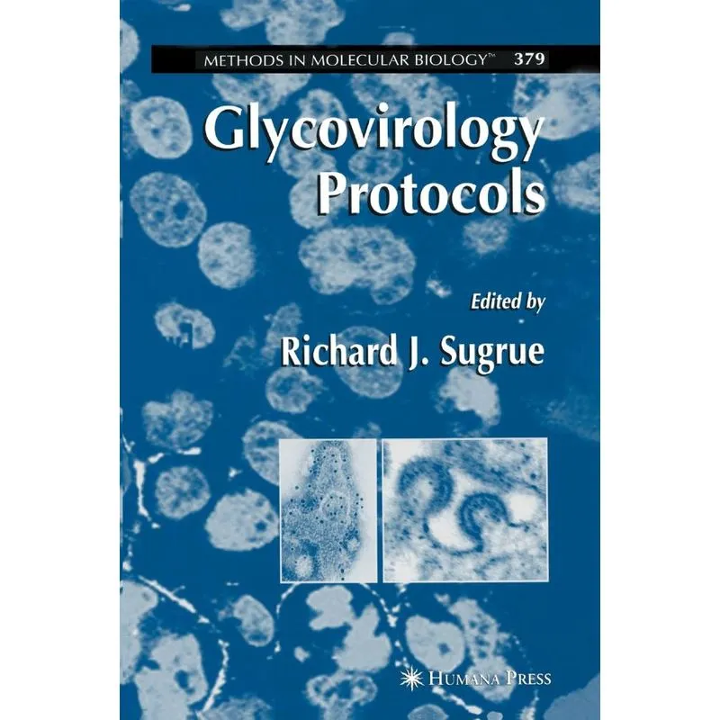 Glycovirology Protocols