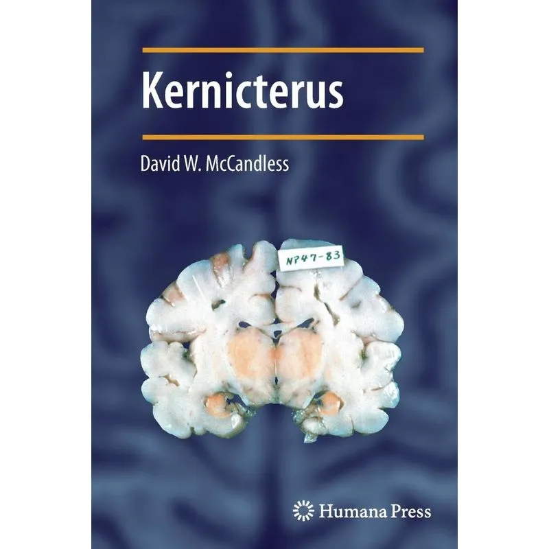 Kernicterus