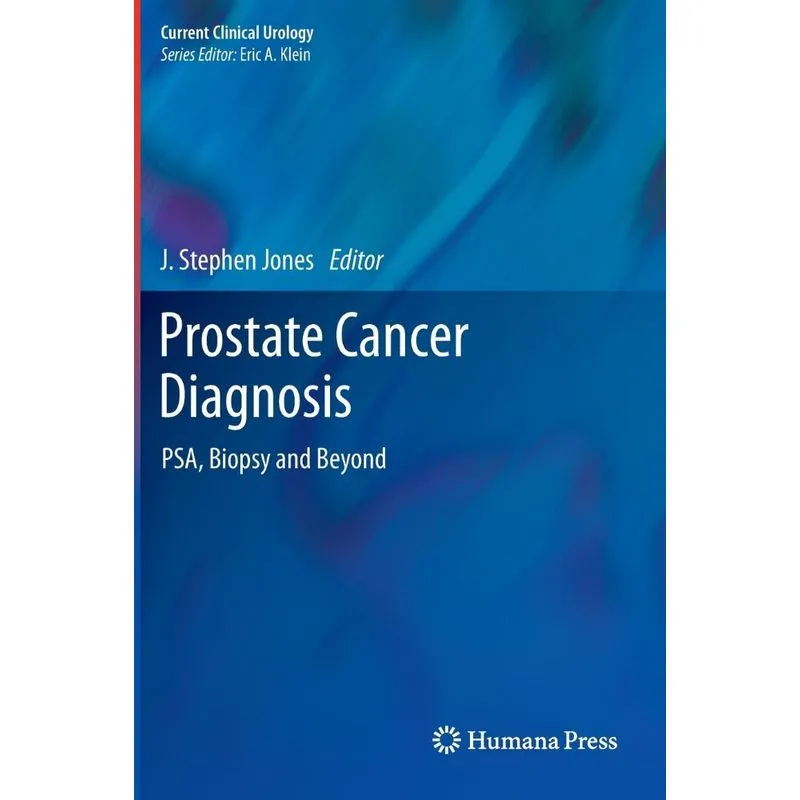 Prostate Cancer Diagnosis