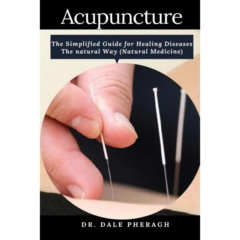 Acupuncture