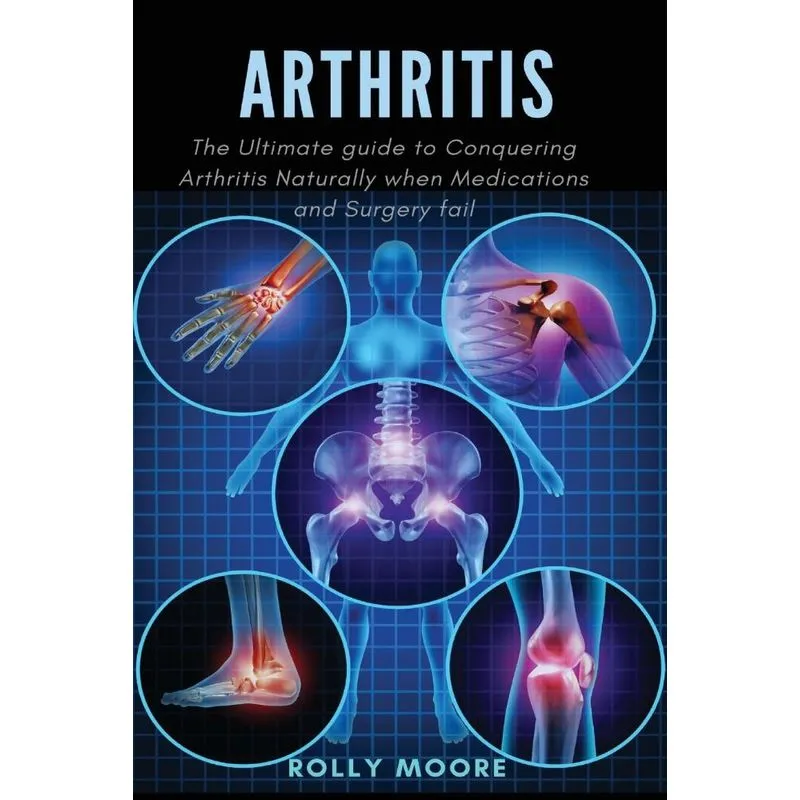 Arthritis
