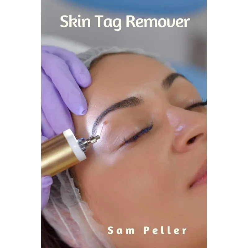 Skin Tag Remover