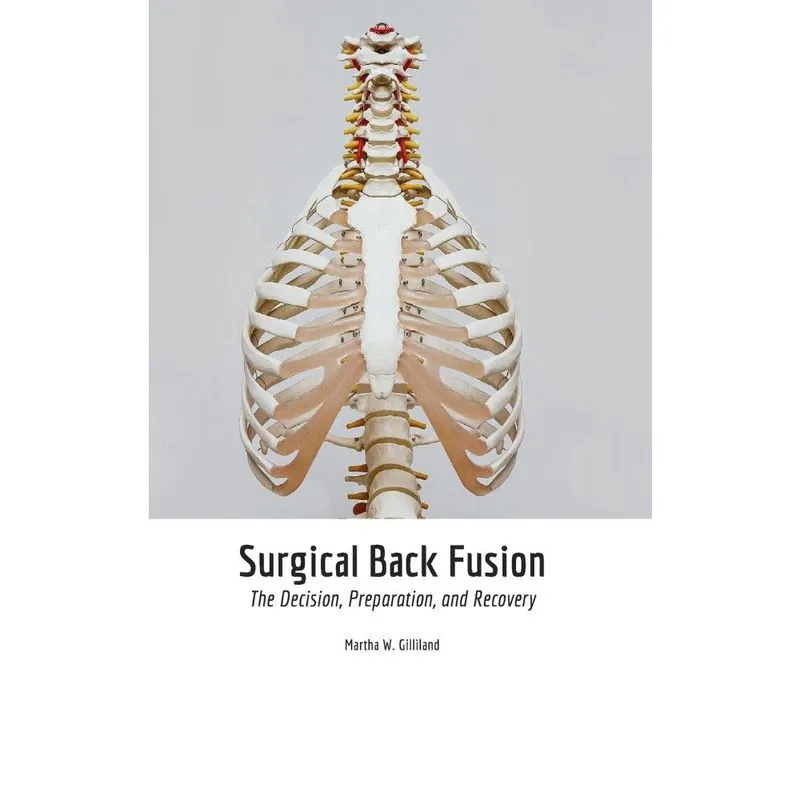 Livro Surgical Back Fusion