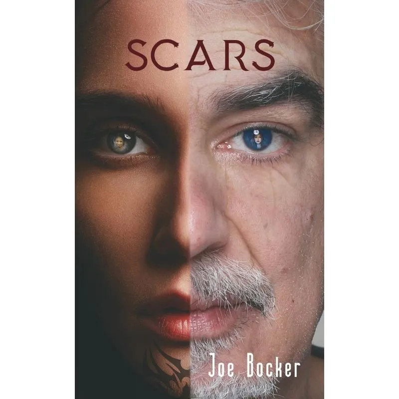 Scars