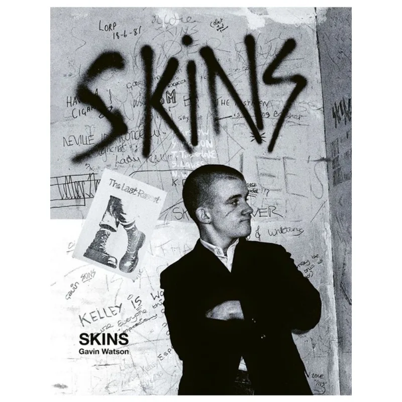 SKINS