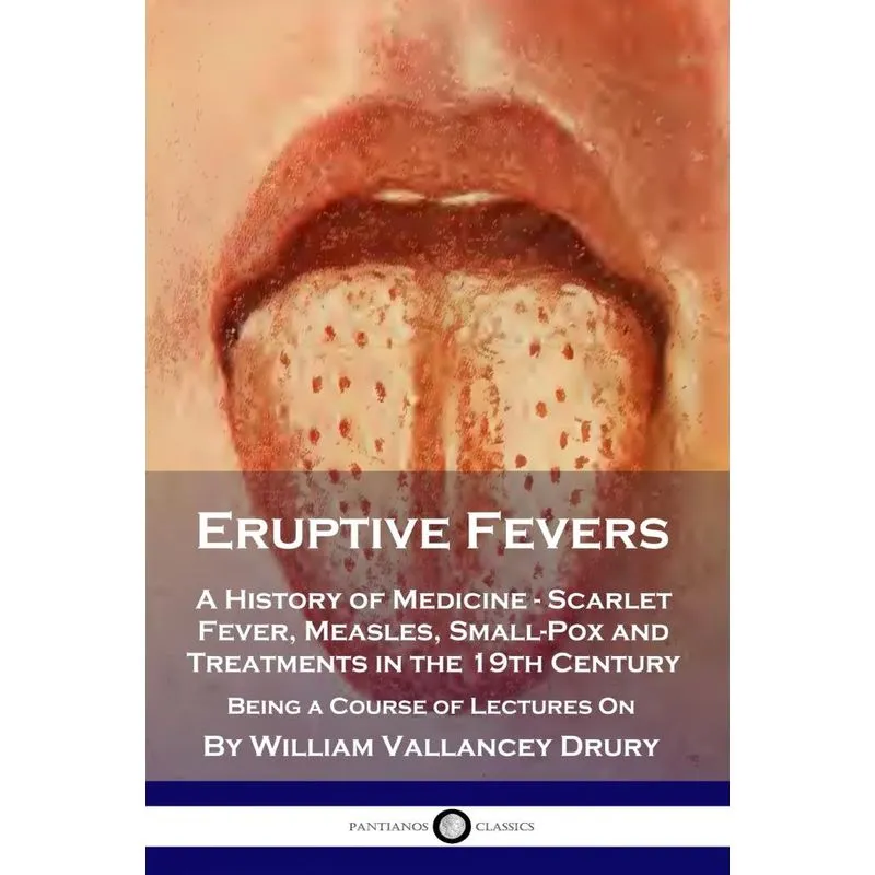 Eruptive Fevers