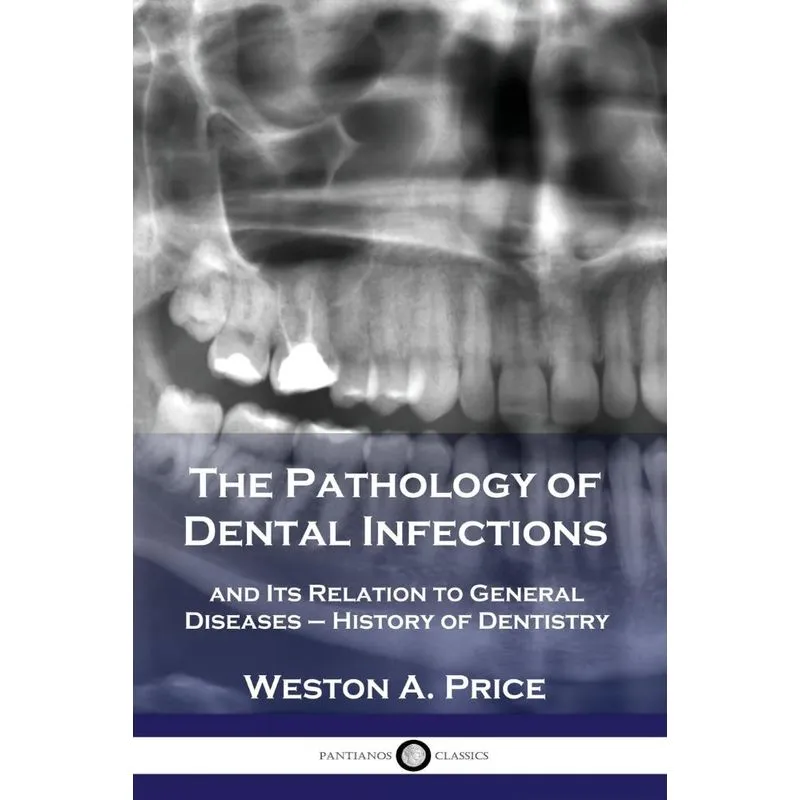 The Pathology of Dental Infections