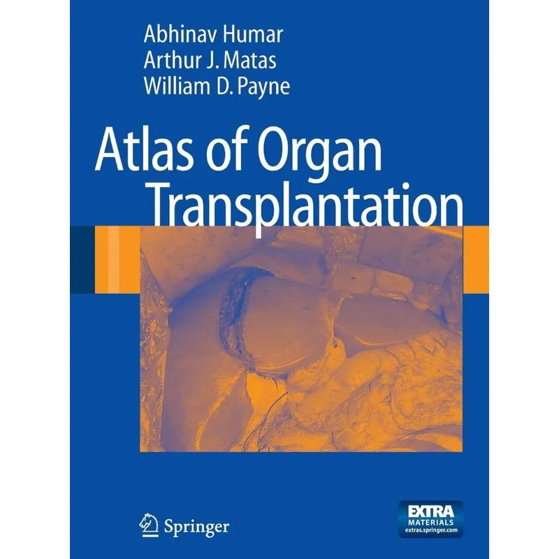 Atlas Of Organ Transplantation