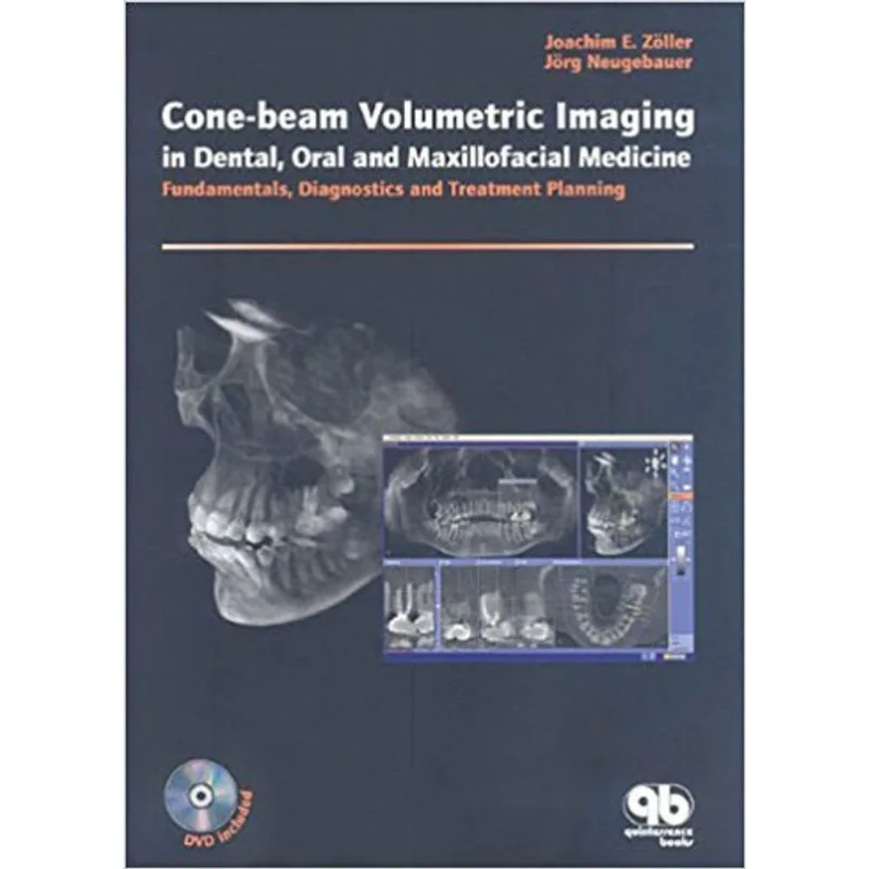 CONE-BEAM VOLUMETRIC IMAGING IN DENTAL, ORAL AND MAXILLOFACIAL MEDICINE